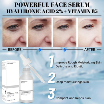 30ml Hyaluronic Acid 2% + B5, Hyaluronic Acid Serum for Face to Plump and Smooth Skin for All Skin Types, 30 ml