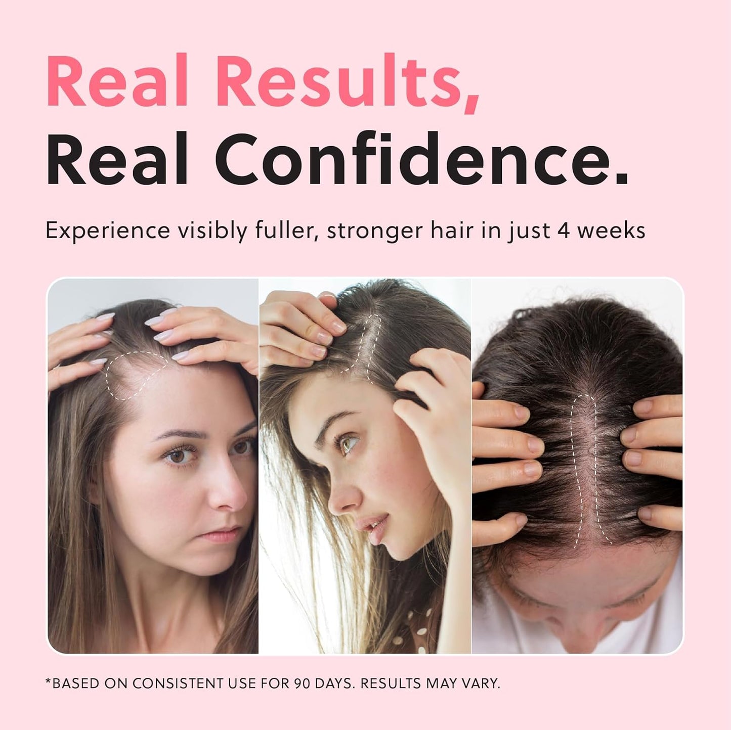 LBOYLOVE® Hair Growth Oil Spray, Advanced Hair Growth Oil for Promoting Thicker Natural Hair, Damage Repair & Loss Prevention, Non-Greasy & Hormone-Free Formula, Ideal for Dry Scalp